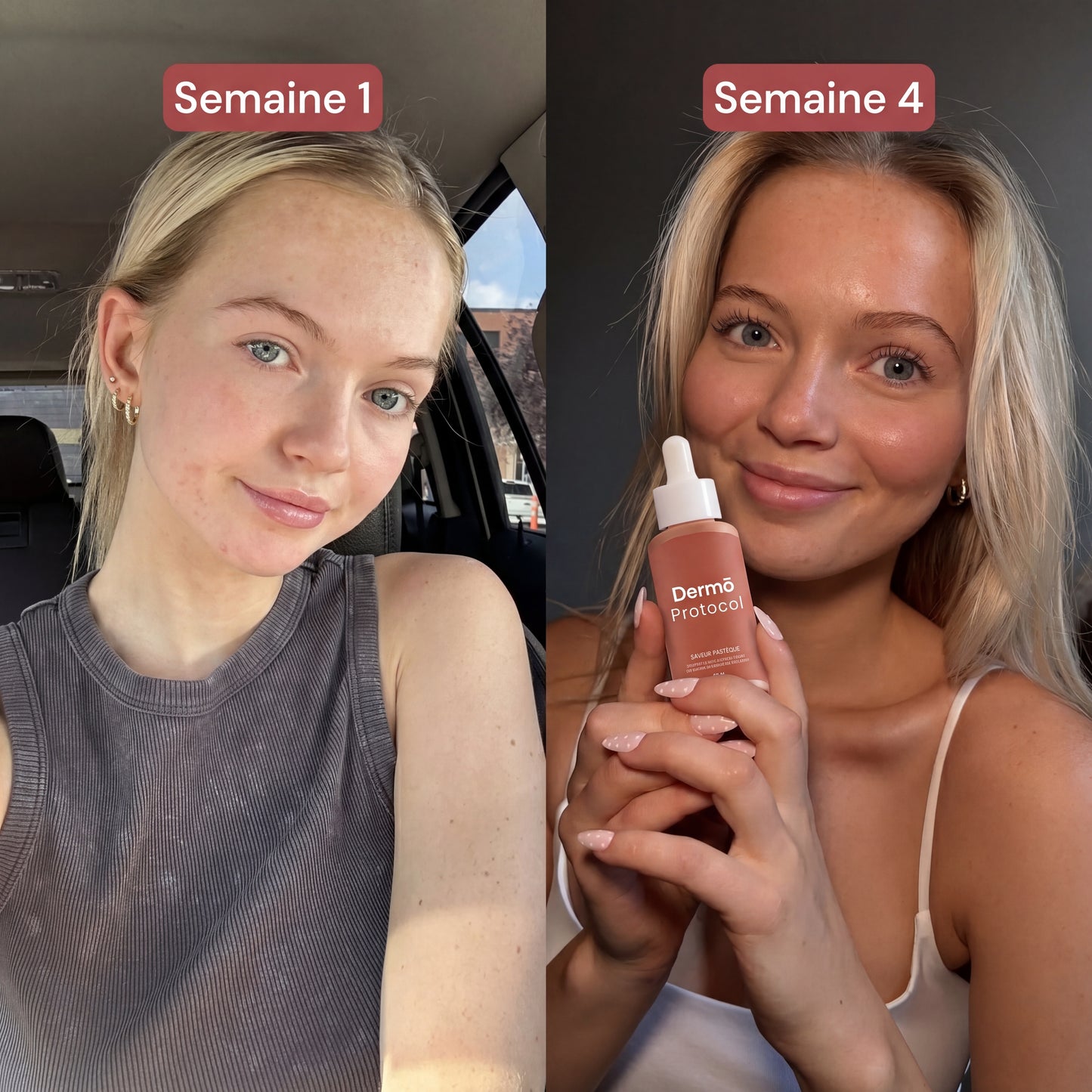 DermōGlow N°07